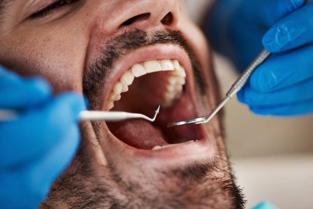 Best Tooth Extraction  in Anderson Island, WA